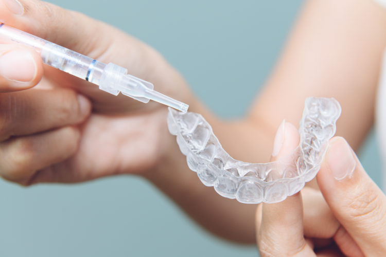 Tooth,Whitening,Gel,Being,Applied,To,A,Tooth,Mold,In