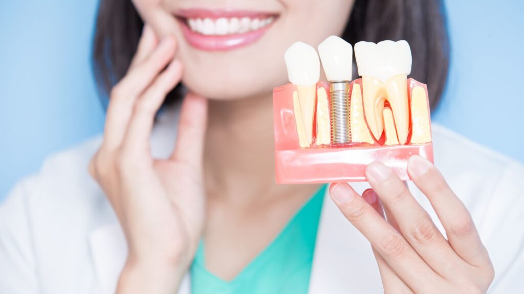 A dentist holding a dental implant model.