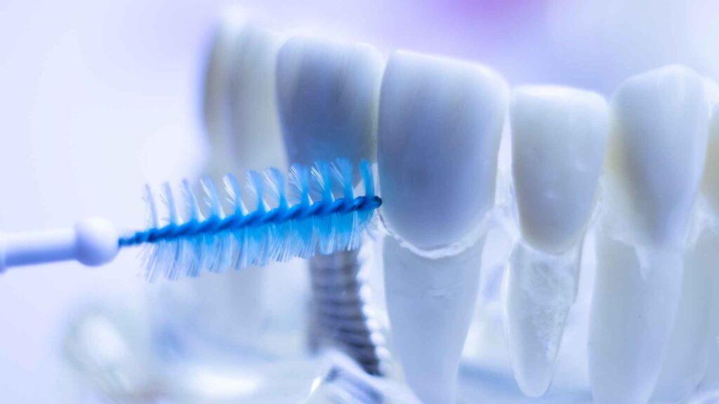 interdental brushes