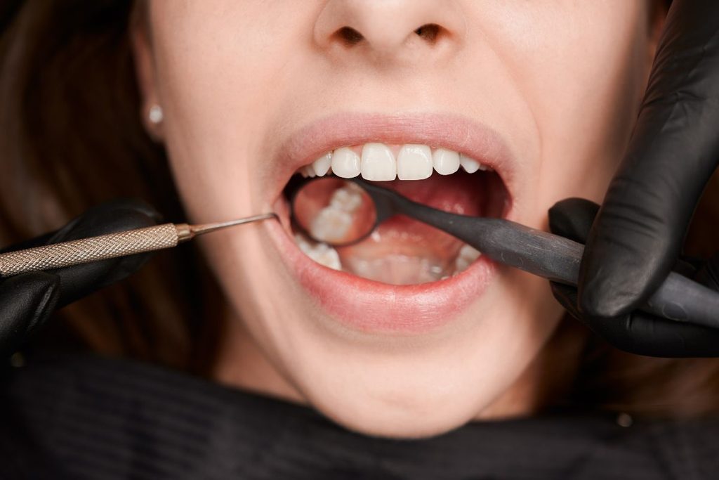patient being examined for broken teeth