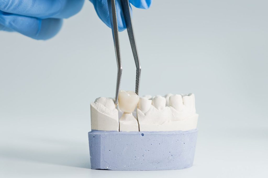 dental crown