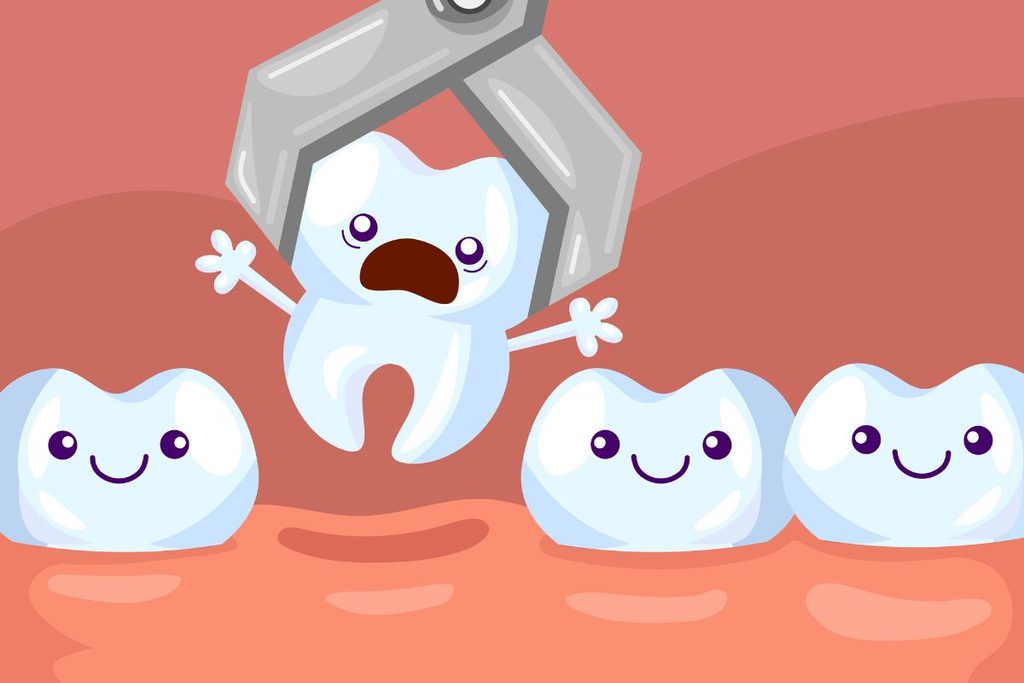 tooth extraction